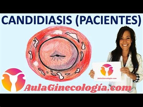 infeccin vajinal fotos reales|Candidiasis vaginal: imágenes, causas, síntomas y tratamiento